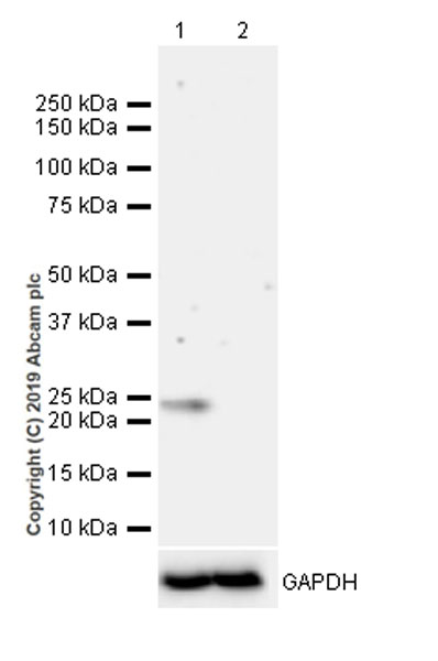 Western blot - Anti-RAB29 antibody [MJF-R30-124] (AB256526), expandable thumbnail