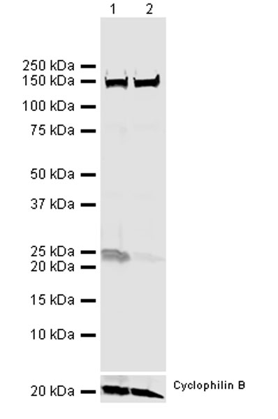 Western blot - Anti-RAB29 antibody [MJF-R30-124] (AB256526), expandable thumbnail