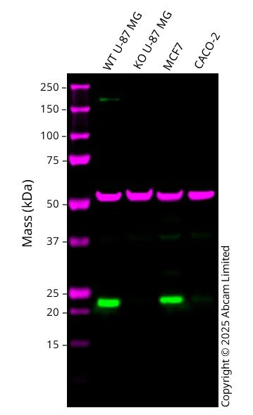 Western blot - Anti-RAB29 antibody [MJF-R30-124] - BSA and Azide free (AB256547)