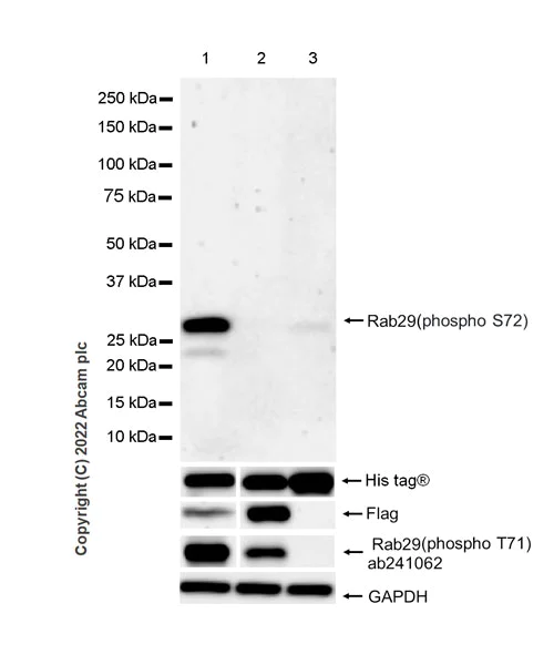 Western blot - Anti-RAB29 (phospho S72) antibody [EPR25173-80] (AB302702)