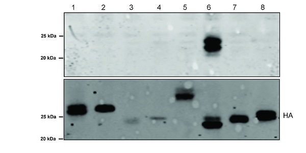 Western blot - Anti-RAB29 (phospho T71) antibody [MJF-R24-17-1] (AB241062)