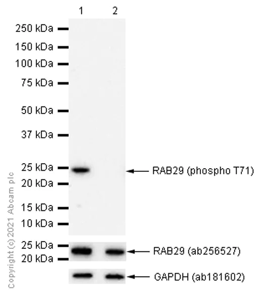 Western blot - Anti-RAB29 (phospho T71) antibody [MJF-R24-17-1] (AB241062)