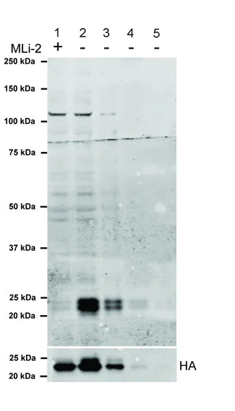 Western blot - Anti-RAB29 (phospho T71) antibody [MJF-R24-17-1] - BSA and Azide free (AB243289)