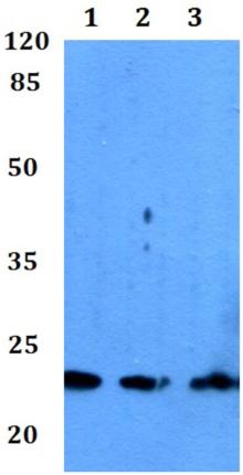 Western blot - Anti-RAB30 antibody (AB192393)