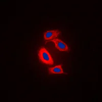 Immunocytochemistry/ Immunofluorescence - Anti-RAB31 antibody (AB230881)