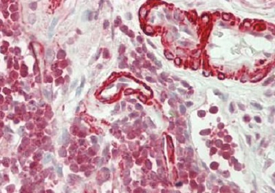 Immunohistochemistry (Formalin/PFA-fixed paraffin-embedded sections) - Anti-RAB31 antibody (AB230881)