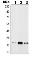 Western blot - Anti-RAB31 antibody (AB230881)