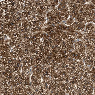 Immunohistochemistry (Formalin/PFA-fixed paraffin-embedded sections) - Anti-RAB31 antibody - C-terminal (AB224421)