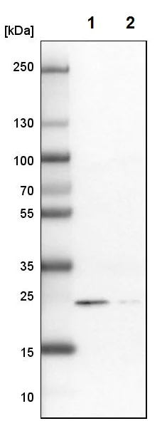 Western blot - Anti-RAB31 antibody - C-terminal (AB224421)