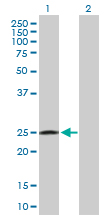 Western blot - Anti-RAB32 antibody (AB103160), expandable thumbnail