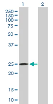 Western blot - Anti-RAB32 antibody (AB103160)