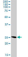 Western blot - Anti-RAB32 antibody (AB103160), expandable thumbnail