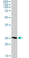 Western blot - Anti-RAB32 antibody (AB103160)