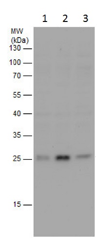 Western blot - Anti-RAB32 antibody (AB229604)