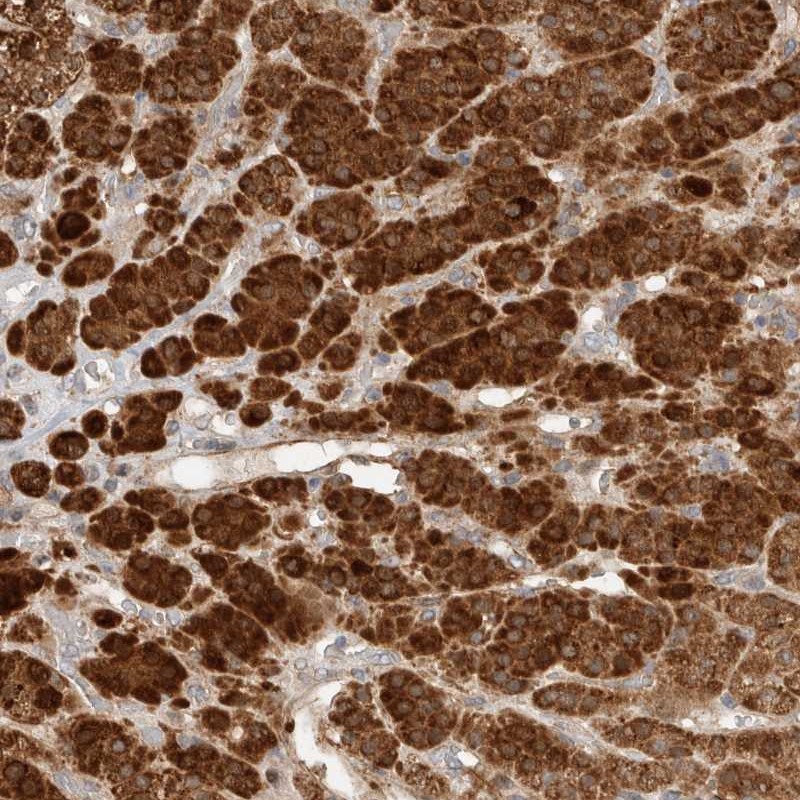Immunohistochemistry (Formalin/PFA-fixed paraffin-embedded sections) - Anti-RAB32 antibody (AB251764), expandable thumbnail