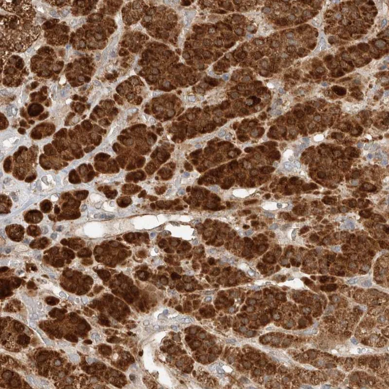 Immunohistochemistry (Formalin/PFA-fixed paraffin-embedded sections) - Anti-RAB32 antibody (AB251764)