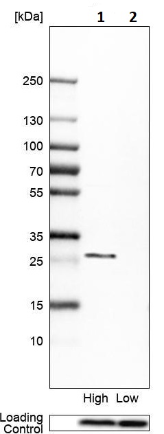 Western blot - Anti-RAB32 antibody (AB251764), expandable thumbnail