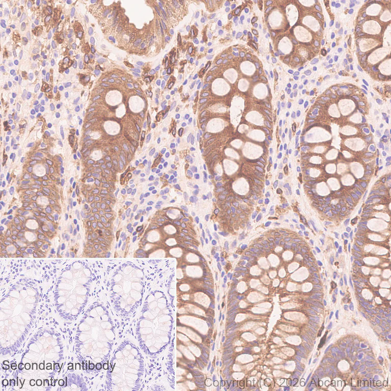 Immunohistochemistry (Formalin/PFA-fixed paraffin-embedded sections) - Anti-RAB32 antibody [EPR30866-551] (AB327057)
