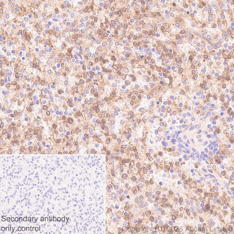Immunohistochemistry (Formalin/PFA-fixed paraffin-embedded sections) - Anti-RAB32 antibody [EPR30866-551] (AB327057)