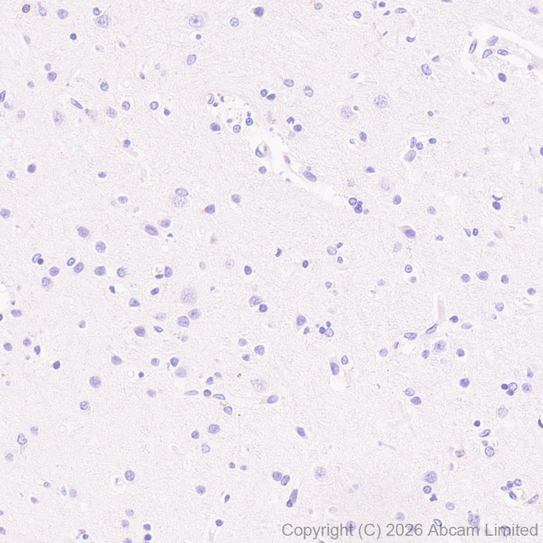 Immunohistochemistry (Formalin/PFA-fixed paraffin-embedded sections) - Anti-RAB32 antibody [EPR30866-551] (AB327057)