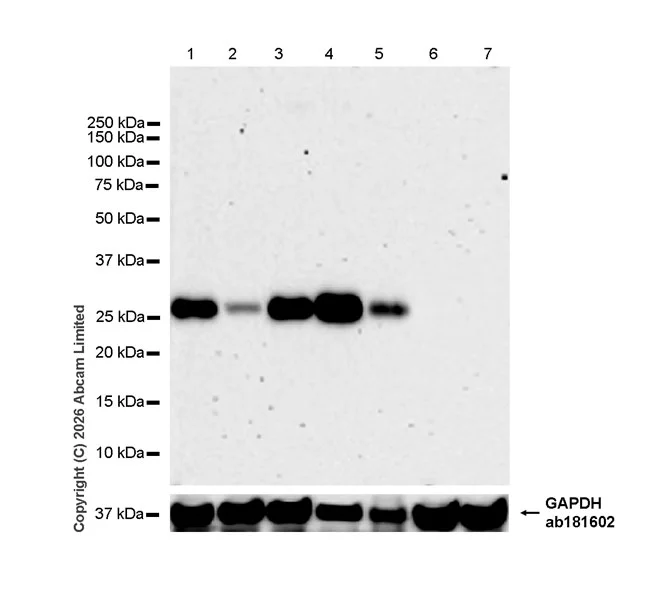 Western blot - Anti-RAB32 antibody [EPR30866-551] (AB327057)