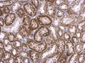 Immunohistochemistry (Formalin/PFA-fixed paraffin-embedded sections) - Anti-RAB33B antibody (AB155679)