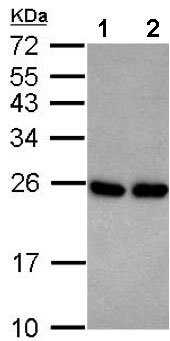Western blot - Anti-RAB33B antibody (AB155679)