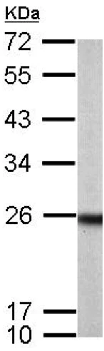 Western blot - Anti-RAB33B antibody (AB155679)
