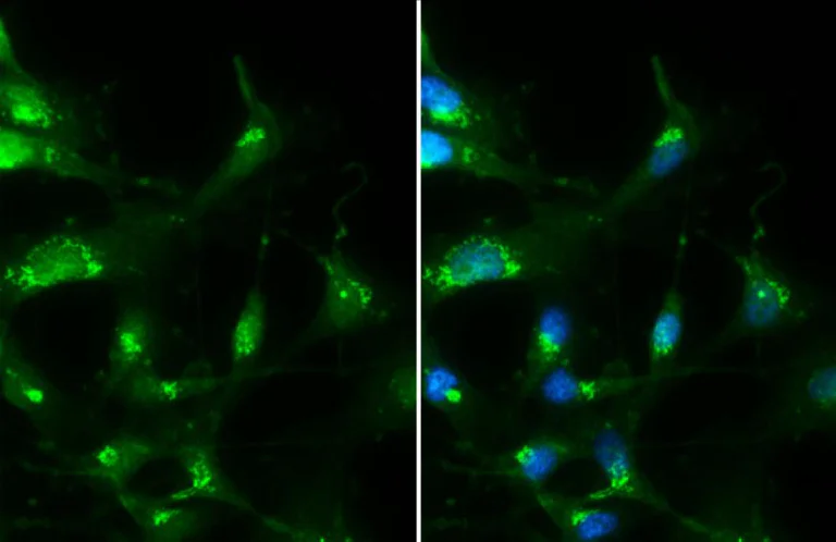Immunocytochemistry/ Immunofluorescence - Anti-RAB35 antibody (AB152138)