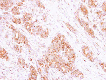Immunohistochemistry (Formalin/PFA-fixed paraffin-embedded sections) - Anti-RAB35 antibody (AB152138)