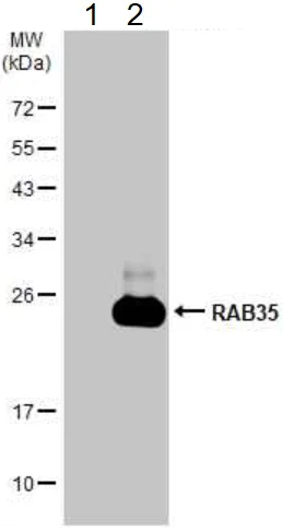 Western blot - Anti-RAB35 antibody (AB152138)