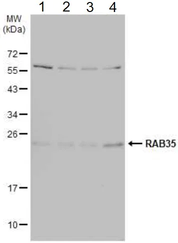 Western blot - Anti-RAB35 antibody (AB152138)