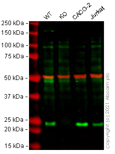 Western blot - Anti-RAB35 antibody (AB152138)