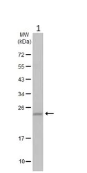 Western blot - Anti-RAB35 antibody (AB152138)