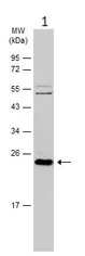 Western blot - Anti-RAB35 antibody (AB152138)