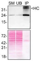 Immunoprecipitation - Anti-RAB35 antibody [EPR24487-21] (BSA and Azide free) (AB300117)