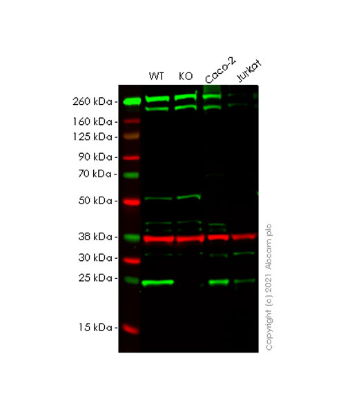 Western blot - Anti-RAB35 antibody [MJF-R34-25] (AB288567), expandable thumbnail