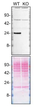 Western blot - Anti-RAB35 antibody [MJF-R34-25] - BSA and Azide free (AB288576)