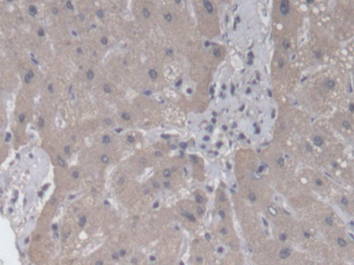 Immunohistochemistry (Formalin/PFA-fixed paraffin-embedded sections) - Anti-RAB37 antibody (AB233114)
