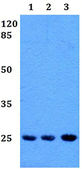 Western blot - Anti-RAB39 antibody (AB191519)