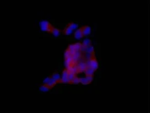 Immunocytochemistry/ Immunofluorescence - Anti-RAB39B antibody [EPR9651] (AB154826)
