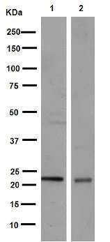 Western blot - Anti-RAB39B antibody [EPR9651] (AB154826)