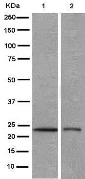 Western blot - Anti-RAB39B antibody [EPR9651] (AB154826)