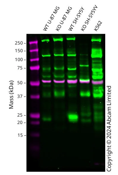 Western blot - Anti-RAB39B antibody [EPR9651] (AB154826)