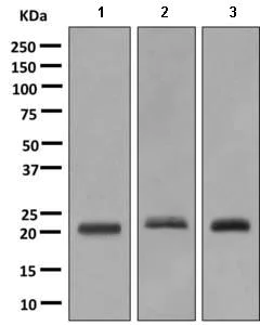 Western blot - Anti-RAB39B antibody [EPR9651] (AB154826)