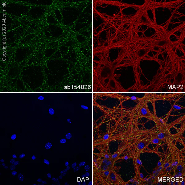 Immunocytochemistry/ Immunofluorescence - Anti-RAB39B antibody [EPR9651] - BSA and Azide free (AB249132)