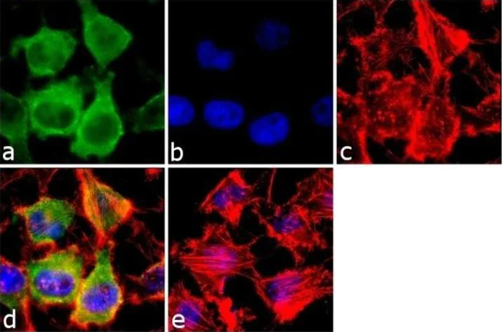 Immunocytochemistry/ Immunofluorescence - Anti-Rab3A antibody (AB3335)