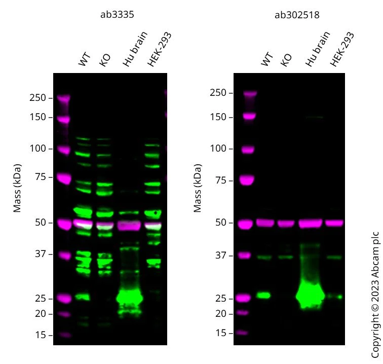Western blot - Anti-Rab3A antibody (AB3335)