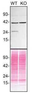 Western blot - Anti-Rab3A antibody [EPR24450-44] (AB285163)