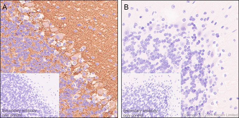 Immunohistochemistry (Formalin/PFA-fixed paraffin-embedded sections) - Anti-Rab3A antibody [EPR26022-9] (AB302518)